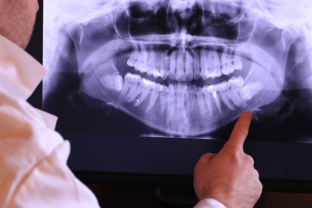 Best Emergency Gum Treatment in Rocky Mount, VA