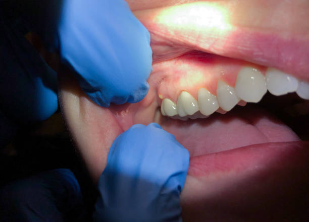 Best Weekend Emergency Dentist in Rocky Mount, VA